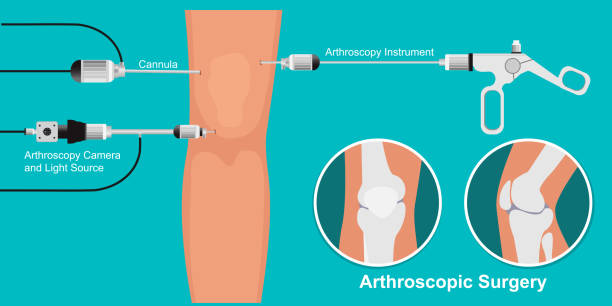 Surgeon For Knee Arthroscopy In Nerul,Seawoods